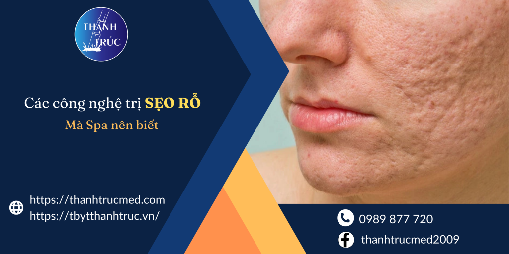 công nghệ trị sẹo rỗ hiệu quả