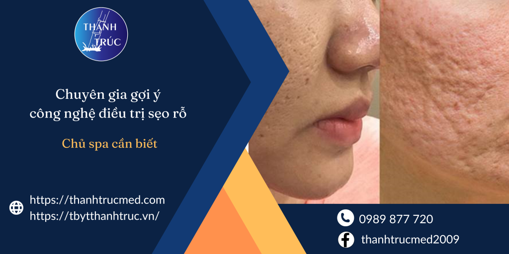 công nghệ điều trị sẹo rỗ
