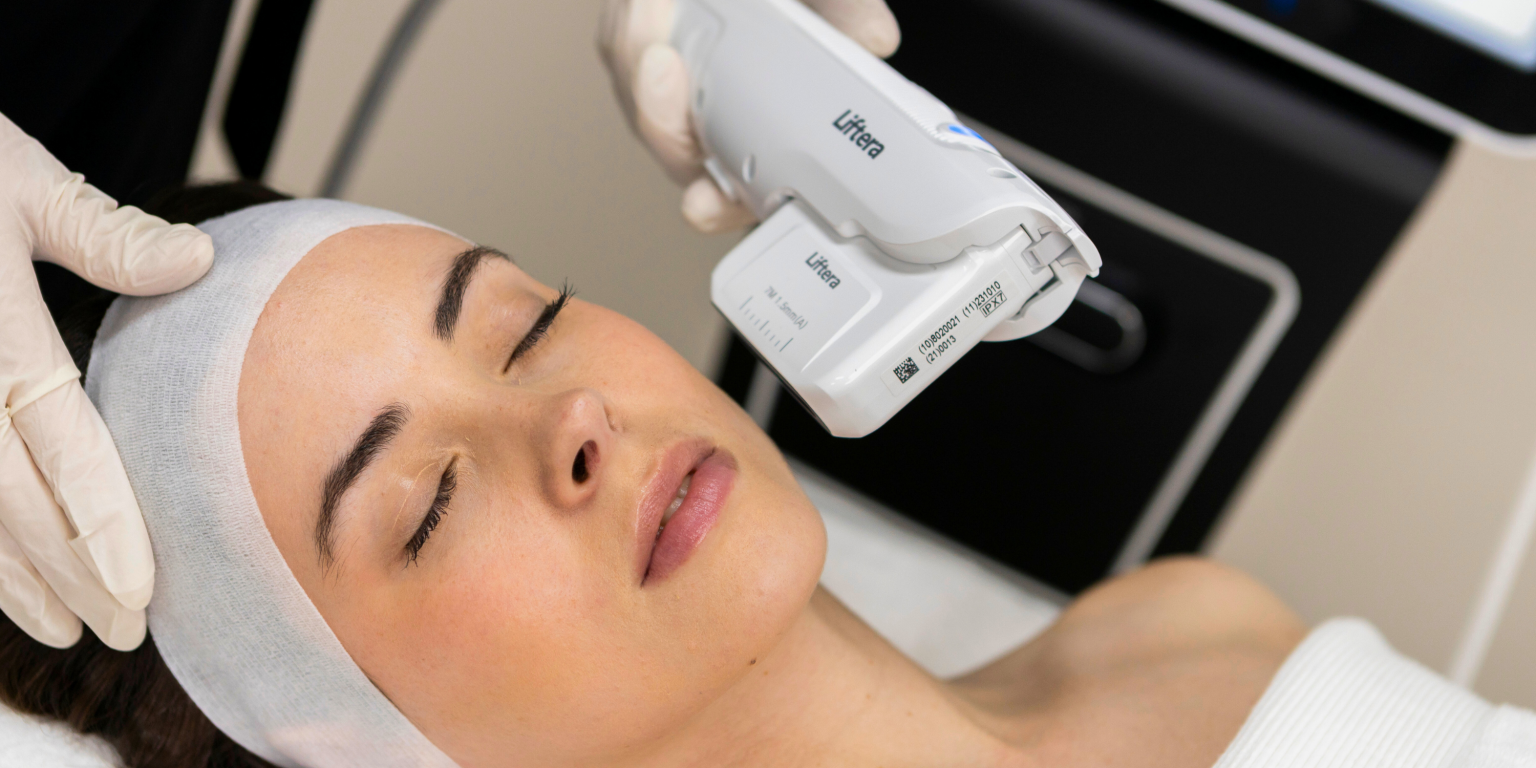 Nang-Co-Tre-Hoa-Bang-Cong-Nghe-HIFU-Ket-Qua-Co-Nhu-Ban-Nghi