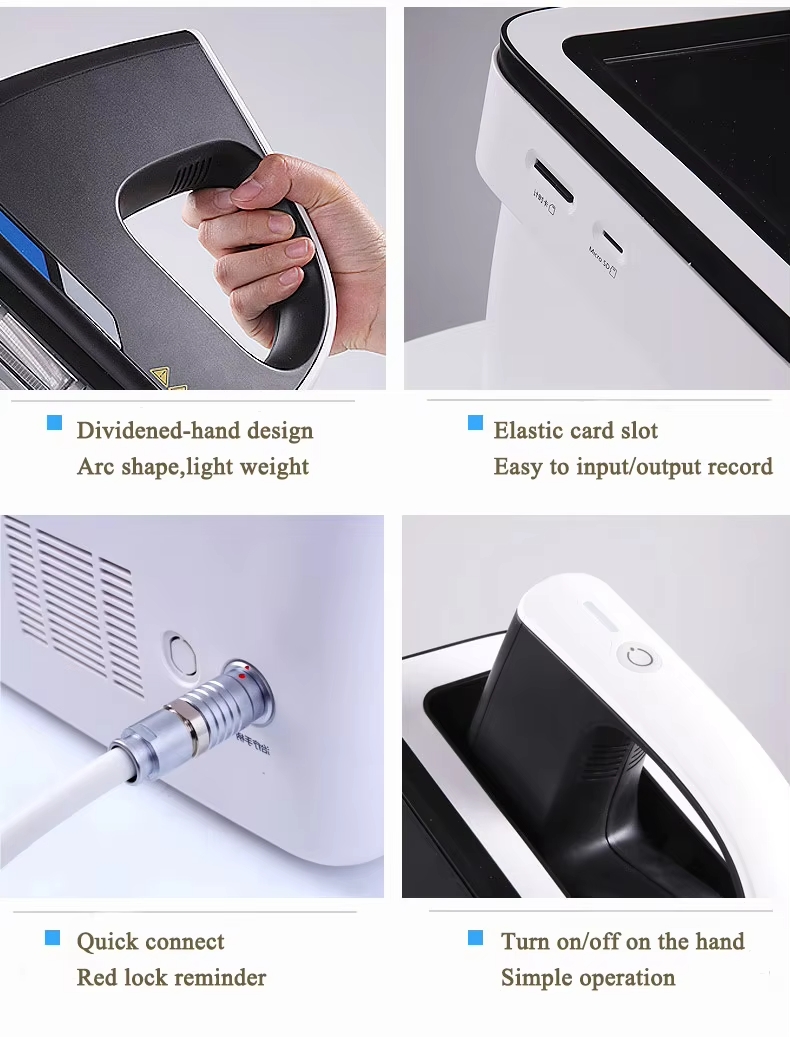 Thông số kỹ thuật máy trị bạch biến