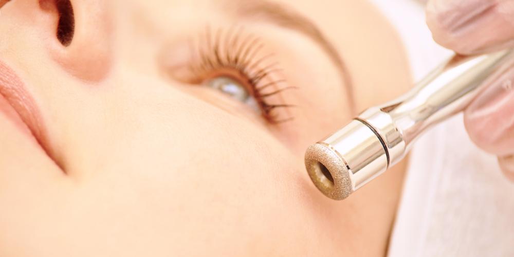 diamond-microdermabrasion