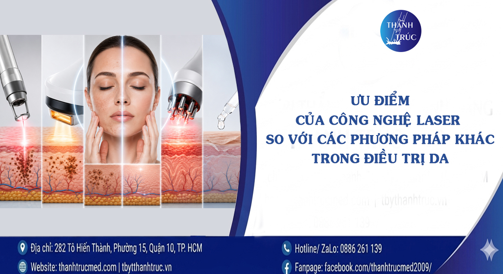 Ưu điểm của công nghệ laser