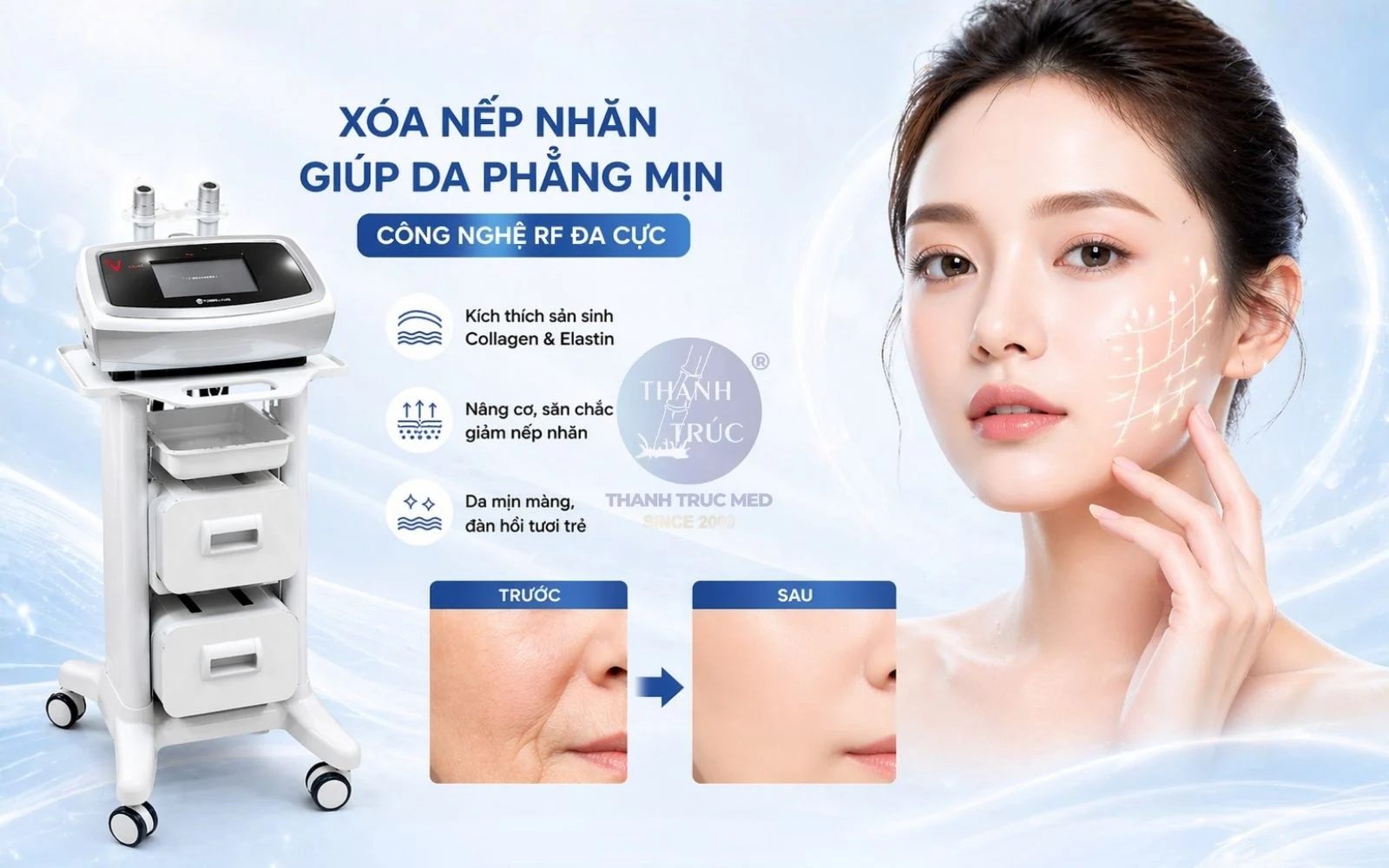 công nghệ RF